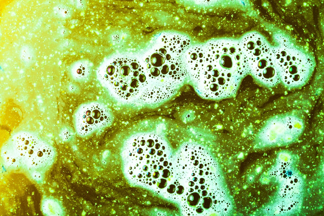 Electric “Wire” Bacteria Discovered – Promises Shocking Solutions